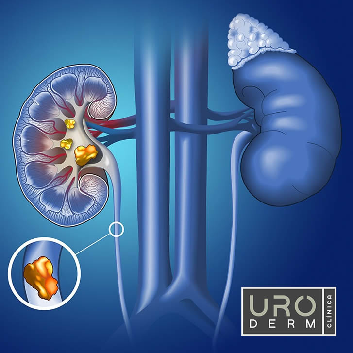 Clínica Uroderm, Urologia e Dermatologia em Montes Claros, MG