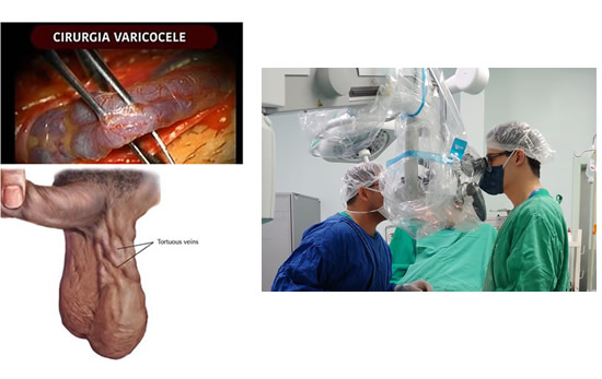 Clínica Uroderm, Cirurgia de Varicocele em Montes Claros, MG